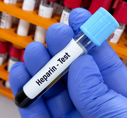 Scientist holding blood sample for Heparin level test, Anti-Xa, Xa inhibition, Antifactor Xa heparin, Heparin Anti-Xa.