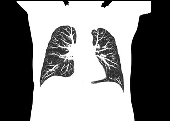 CT scan of Chest or lung  at radiology department in hospital. Covid-19 scan body xray test detection for covid virus epidemic spread concept