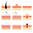 vector illustration of human skin structure anatomy. various skin conditions. epidermis and desmis. illustration for science and medical health.