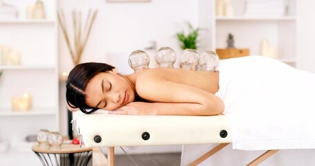 Poster - Relax, cupping and woman at a spa for back pain healing or physical therapy treatment with stress relief. Relaxed, wellness and sleeping girl enjoys luxury healthcare for muscle injury or body energy