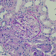 Poster - Camera photo of normal glomeruli and renal tubules, PAS stain, magnification 400x, photograph through a microscope