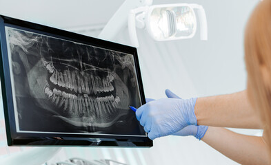 Hands doctor dentist in gloves show the teeth on x-ray on digital screen in dental clinic on light background with medical equipment. Smile healthy teeth concept, close up