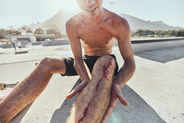 skater, knee pain and man with blood on injury after a skateboard accident in sports skate park in s