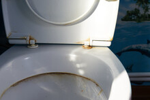 Old And Dirty Toilet Seats, Yellow Stains, Poor Condition.