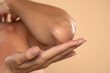 © vladimirfloyd - Close-up of a woman takes care of his elbows using cosmetic cream on a beige background