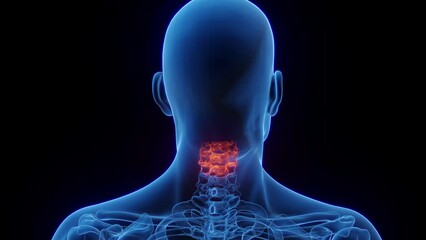 Wall Mural - 3D rendered Medical Animation of inflammation of a man's Cervical Spine