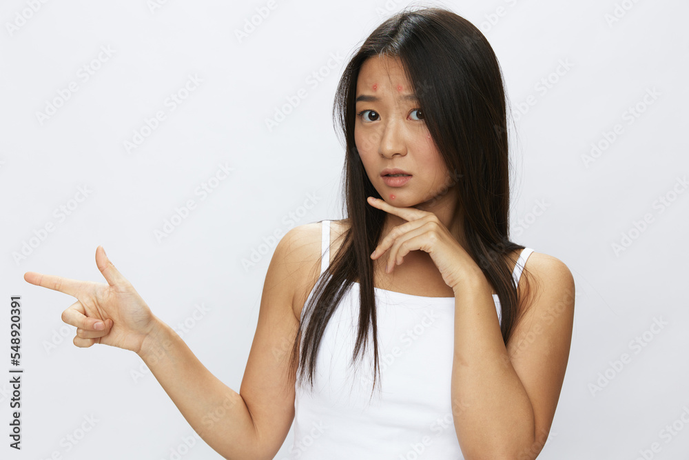 Asian woman hand signals, finger pointing facial skin problems, acne ...