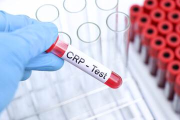 Poster - CRP test to look for abnormalities from blood