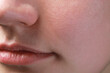 © New Africa - Closeup view of woman with normal skin and beautiful lips