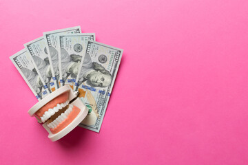 Closeup model of a human jaw with white teeth and dollar bill. Dentistry conceptual photo. Prosthetic dentistry. False teet top view with copy space