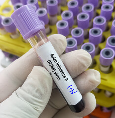 blood sample positive for avian influenza type a (h3n8) virus test, avian influenza virus (aiv), avi