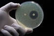 A doctor's or researcher's hand holding a Petri dish with a culture of bacteria on which an antibiotic disc test is performed. Antimicrobial resistance concept