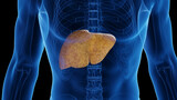 Fototapeta  - 3D medical illustration of a man's fatty liver