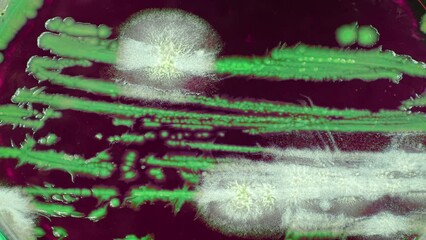 Sticker - timelapse of growth of microflora samples in a petri dish in a soil research laboratory