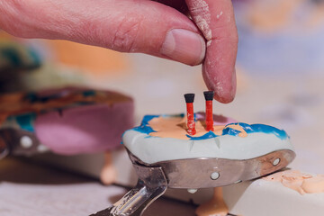 The process of making a dental prosthesis in a dental laboratory.