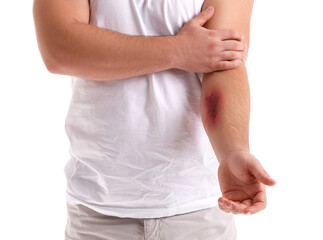 Man with bruise on arm against white background