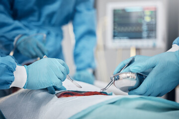 Canvas Print - Hands, blood and operation with a team of doctors at work during surgery with equipment or a tool in a hospital. Doctor, nurse and collaboration with a medicine professional group saving a life