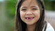Portrait of a happy little girl closeup face with missing teeth. Joyful female child toothless front tooth smiling