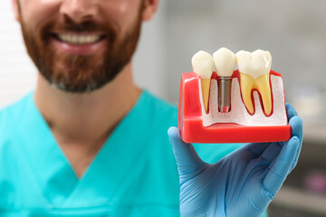 Sticker - Dentist holding educational model of dental implant on blurred background, closeup. Space for text