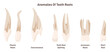Anomalies of teeth roots. Adult human teeth, molar premolar canine incisor