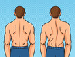 Man back with scoliosis pinup pop art retro vector illustration. Comic book style imitation.