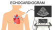Echocardiogram. Heart ultrasound.  Medical Vector illustration of Echocardiogram for articles, posters, banners.  Cardiology Echo test. Diagnose cardiac problem. Preventing, diagnosing a heart attack.
