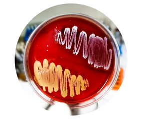 Sticker - Bacterial colony on patri dish.