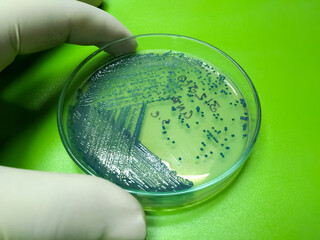 hicrome uti agar media pure growth of escherichia coli or e.coli bacteria at medical microbiology la