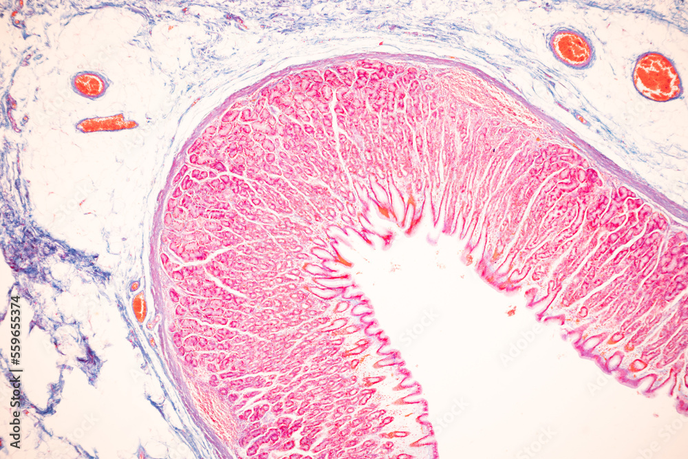 Tissue of Small intestine (Duodenum), Large intestine Human and Stomach ...