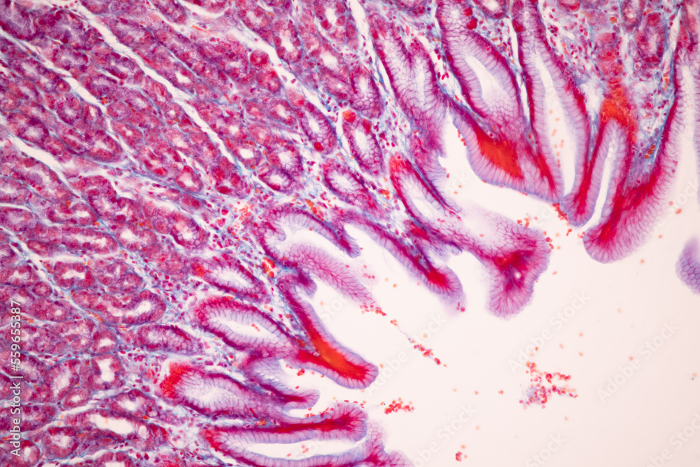 Tissue of Small intestine (Duodenum), Large intestine Human and Stomach ...