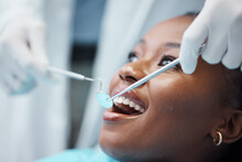 Black Woman, Mouth And Face With Dentist, Tools In Hands And Dental, Teeth Check For Healthcare With Tooth Decay. Tooth Surgery, Orthodontics And Smile, Teeth Whitening, Closeup And Invisalign