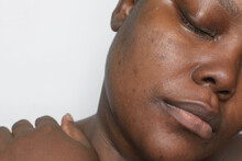 Brown Skin With Dark Spots, Hyperpigmentation On Brown Skin, African American Woman With Skin Blemishes, Imperfect Skin