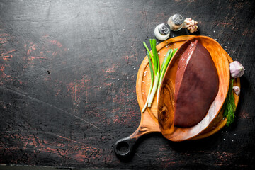 Poster - Raw liver on a plate of greens and garlic cloves.