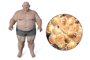 Wall Mural - Obese man and close-up view of fat cells, 3D illustration. Concept of obesity