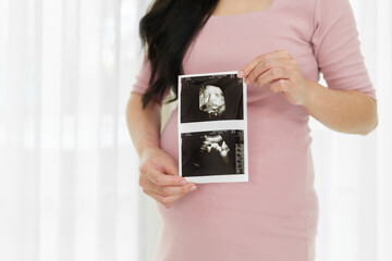 close up pregnant woman showing ultrasound photo of baby on window background