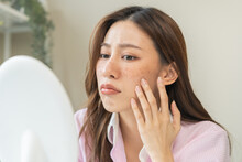 Dermatology, Expression Face Worry, Stressed Asian Young Woman Hand Touching Facial At Dark Spot Of Melasma, Freckles From Pigment Melanin, Allergy Sun. Beauty Care, Skin Problem Treatment, Skincare.