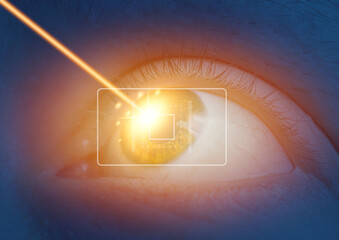 Sticker - close up of female eye with laser beam hitting the iris