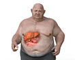 Fibrotic liver in obese man, 3D illustration. Concept of obesity and inner organs diseases