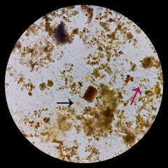 Wall Mural - Giardia lamblia cysts and Trophozoite form, muscle fiber in stool examination, under 40X light microscope, selective focus.