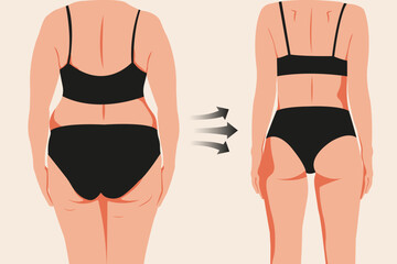 The back view of a woman's body before and after losing weight. Vector illustration in flat style for creating fitness content