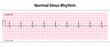 ECG Normal Sinus Rhythm - 8 Second ECG Paper - Vector Medical Illustration