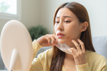 Expression worry asian young woman hand touching pustule around the chin and mouth, allergic when wear mask, makeup, show squeezing pimple spot from face. Beauty care, skin problem by acne treatment.