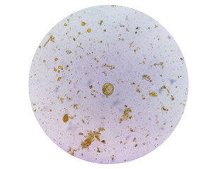 Poster - Microscopic examination of Stool showing Blastocystis hominis parasite.