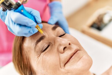 Canvas Print - Middle age caucasian woman having anti-aging face treatment at beauty center