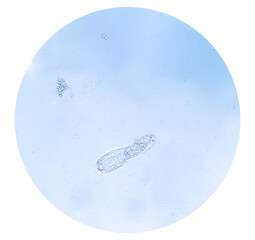 Wall Mural - Schistosoma Haematobium Parasite in human urine specimen under microscope. Urinary parasite