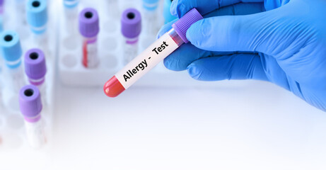 Doctor holding a test blood sample tube positive with allergy test on the background of medical test tubes with analyzes.Copy space for text