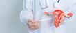 © Jo Panuwat D - Doctor holding Uterus and Ovaries model. Ovarian and Cervical cancer, Cervix disorder, Endometriosis, Hysterectomy, Uterine fibroids, Reproductive system and Pregnancy concept