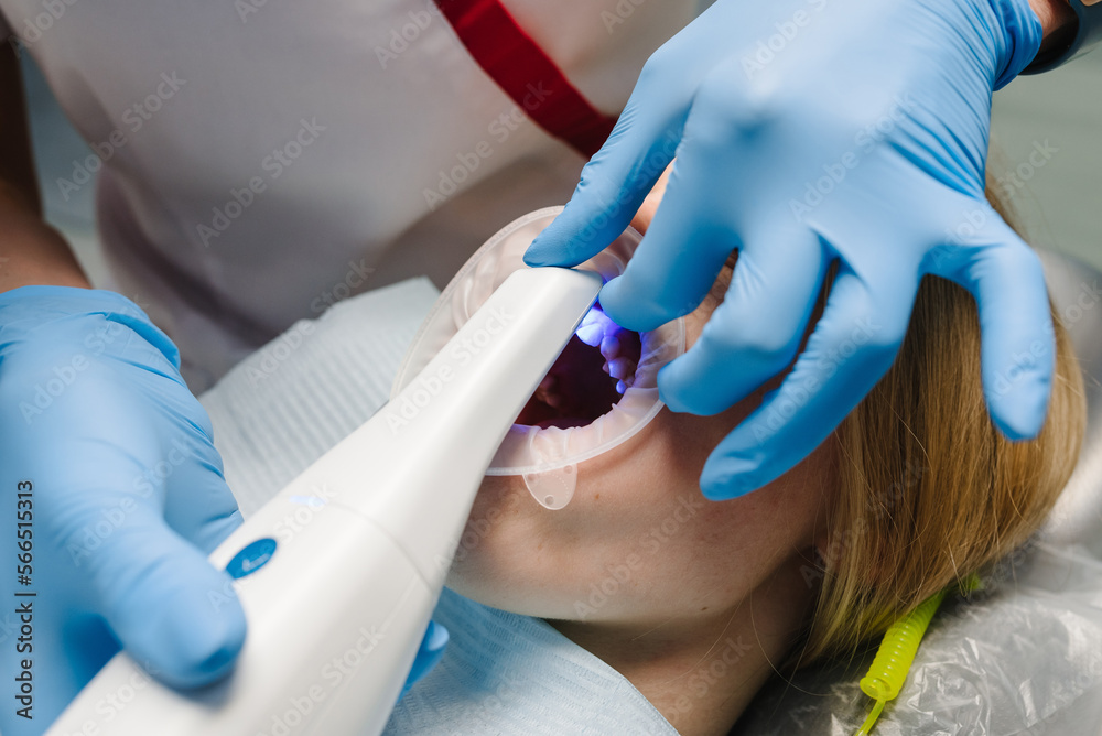 Orthodontist using intraoral 3d scanner for scanning teeth patients ...