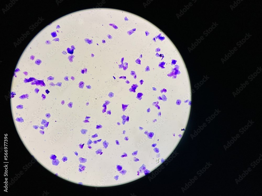 View in microscopic of dog vaginal smear cells.Squamous epithelium cells.Superficial and intermediate epithelial cells.