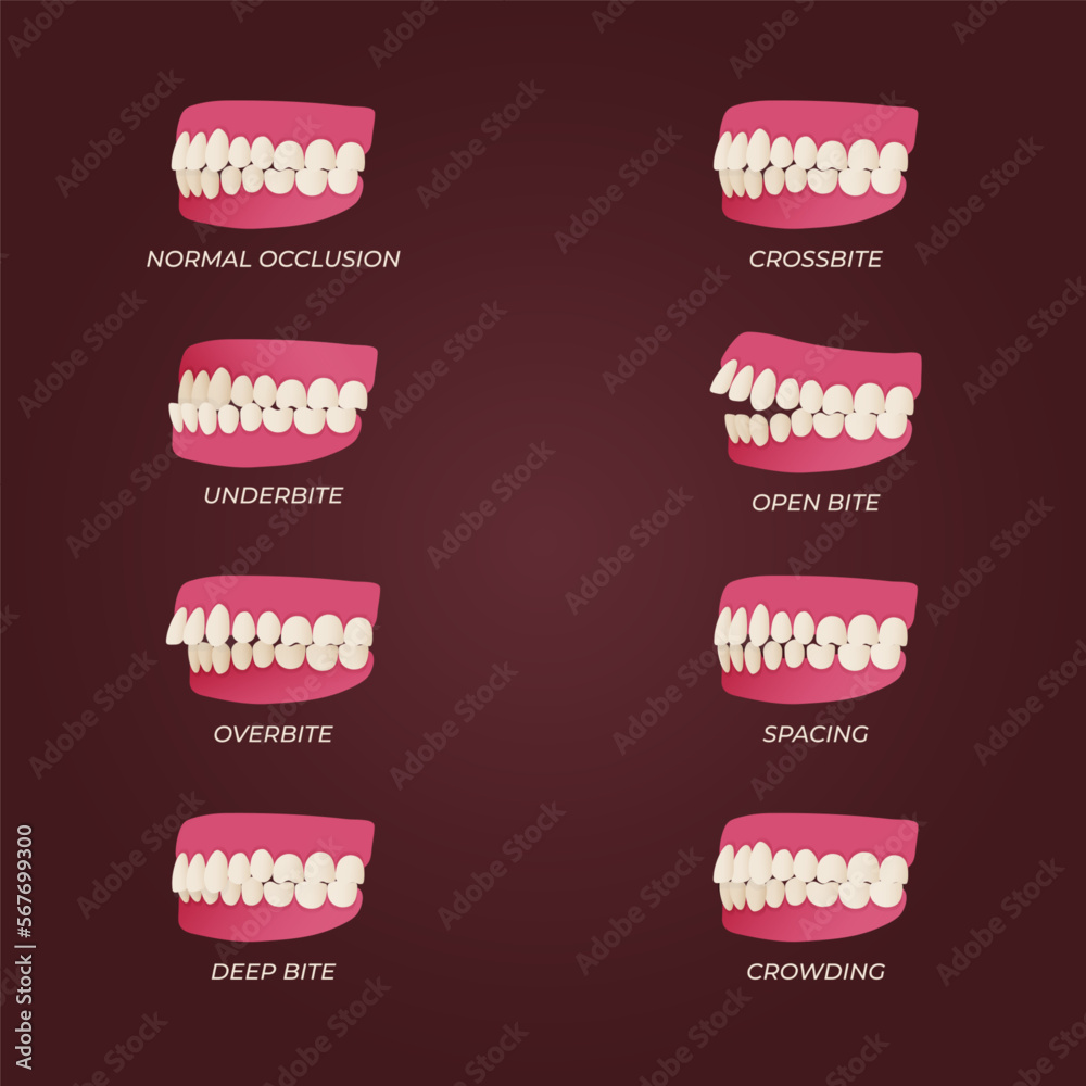 Medical dental diagram illustration. Orthodontist human tooth anatomy ...